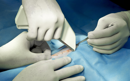 Veterinarian surgical staple procedure