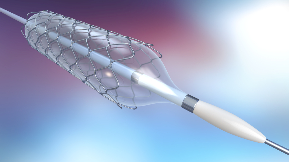 Catheter reinforcement wire